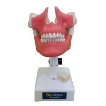 4101 GT - Manequim Com Ruga Palatina e Linha Mucogengival