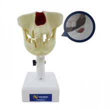 4401 - Manequim Pré-Molar Com 3º Molar Incluso