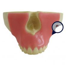 4402 G-01 - Maxila Com Todos Os Dentes e Gengiva + 3º Molar Incluso