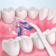 Irrigador Bucal Oral Recarregável Usb Elétrico Water Pick
